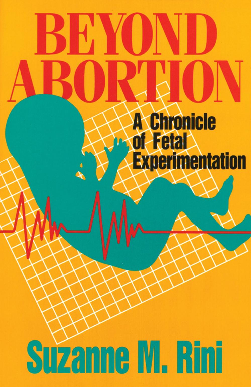 Big bigCover of Beyond Abortion