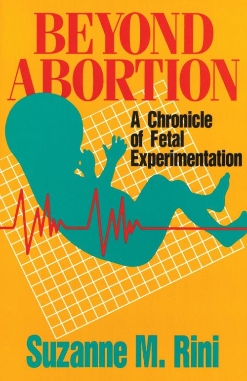 Cover of the book Beyond Abortion by Suzanne Rini, TAN Books