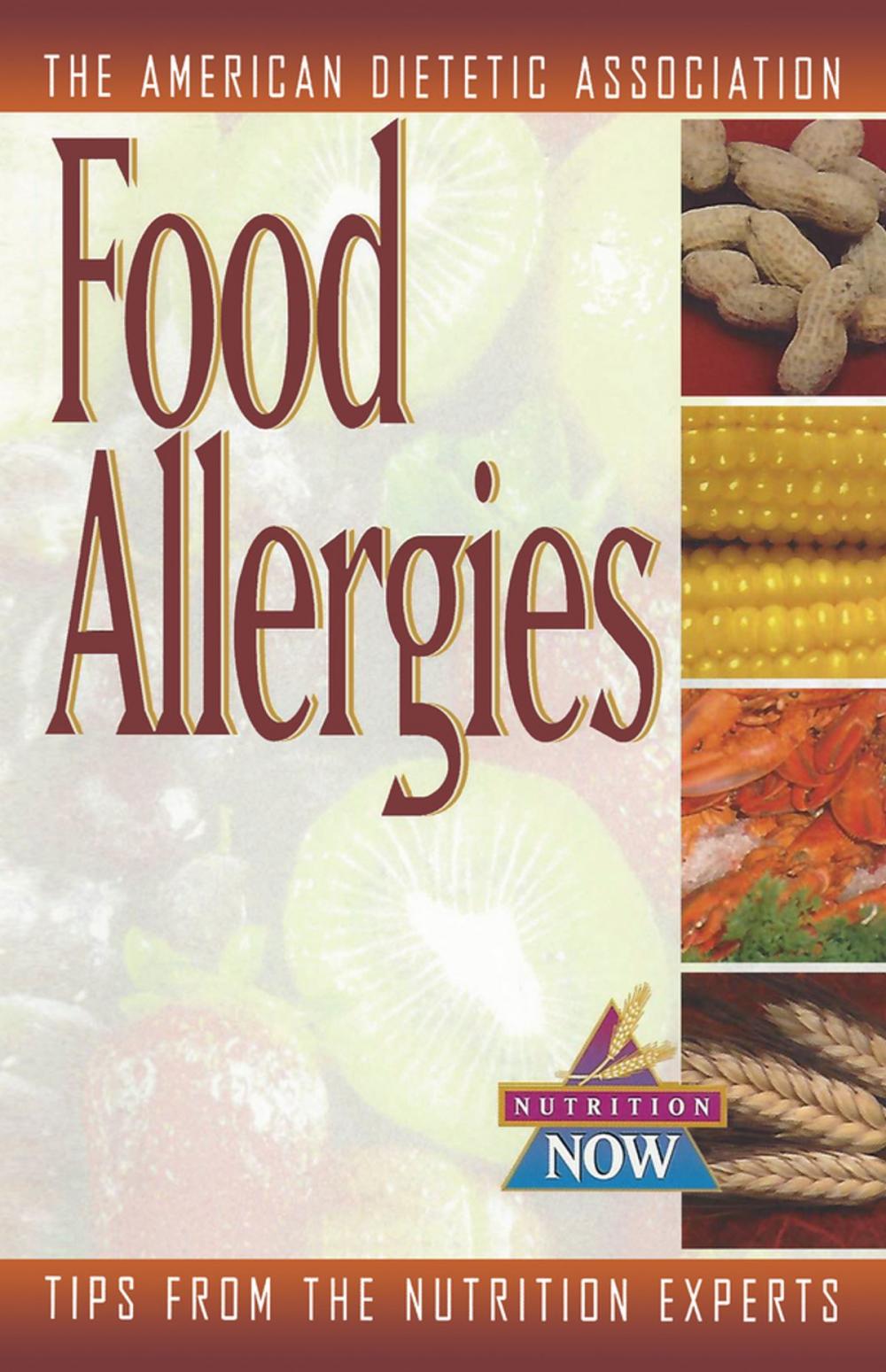 Big bigCover of Food Allergies