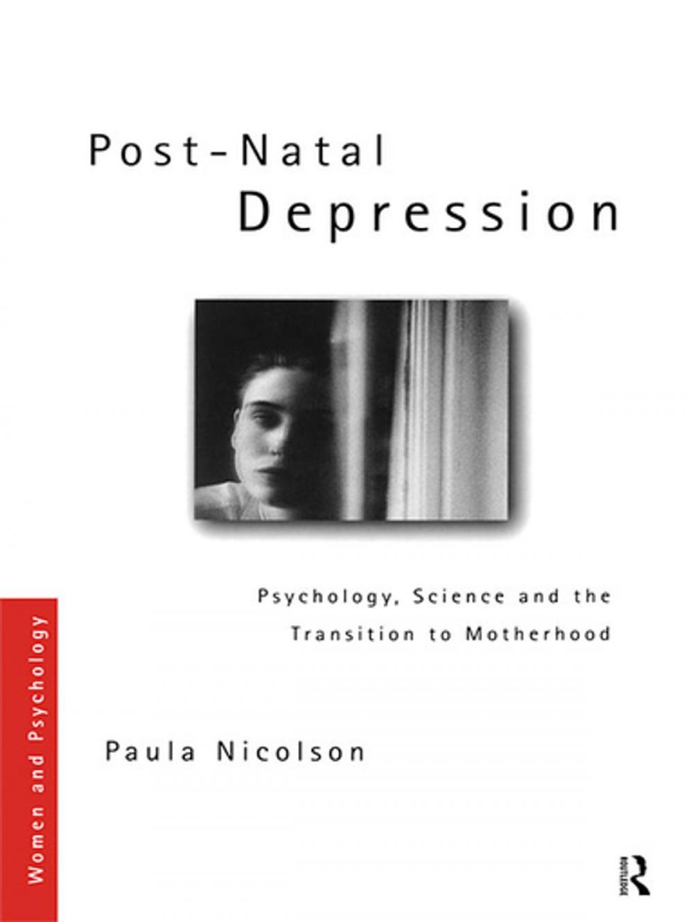 Big bigCover of Post-Natal Depression