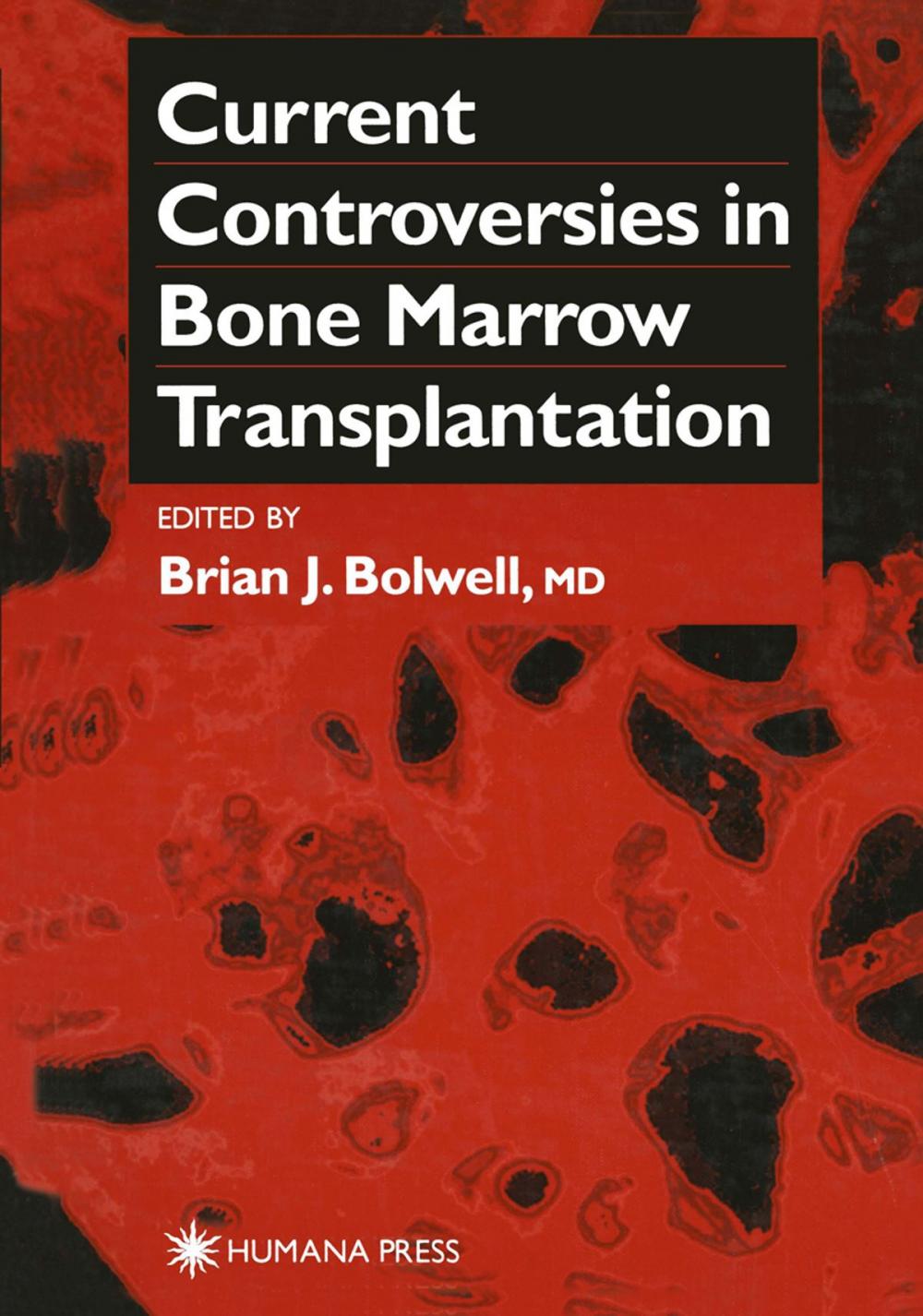 Big bigCover of Current Controversies in Bone Marrow Transplantation