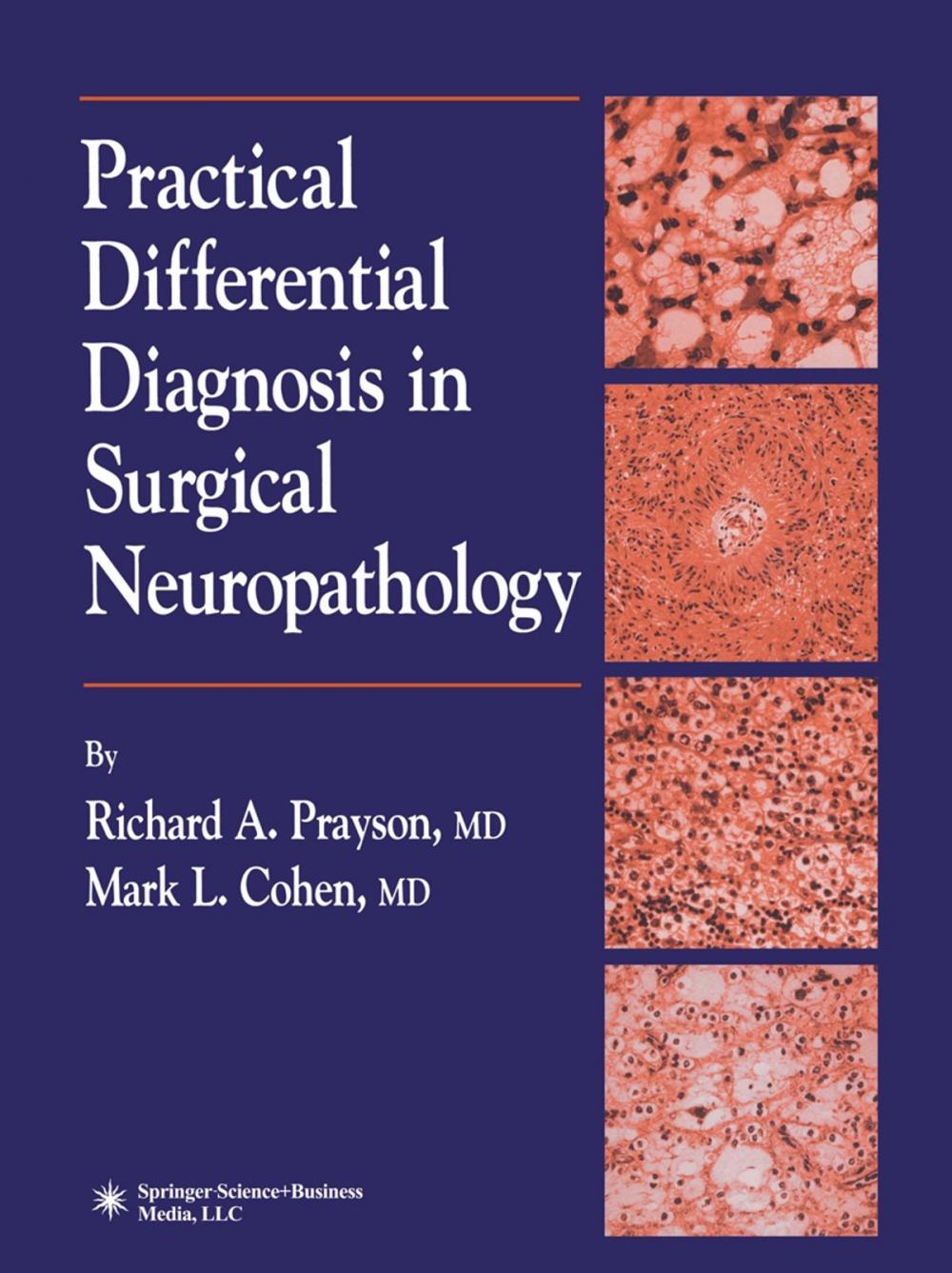 Big bigCover of Practical Differential Diagnosis in Surgical Neuropathology