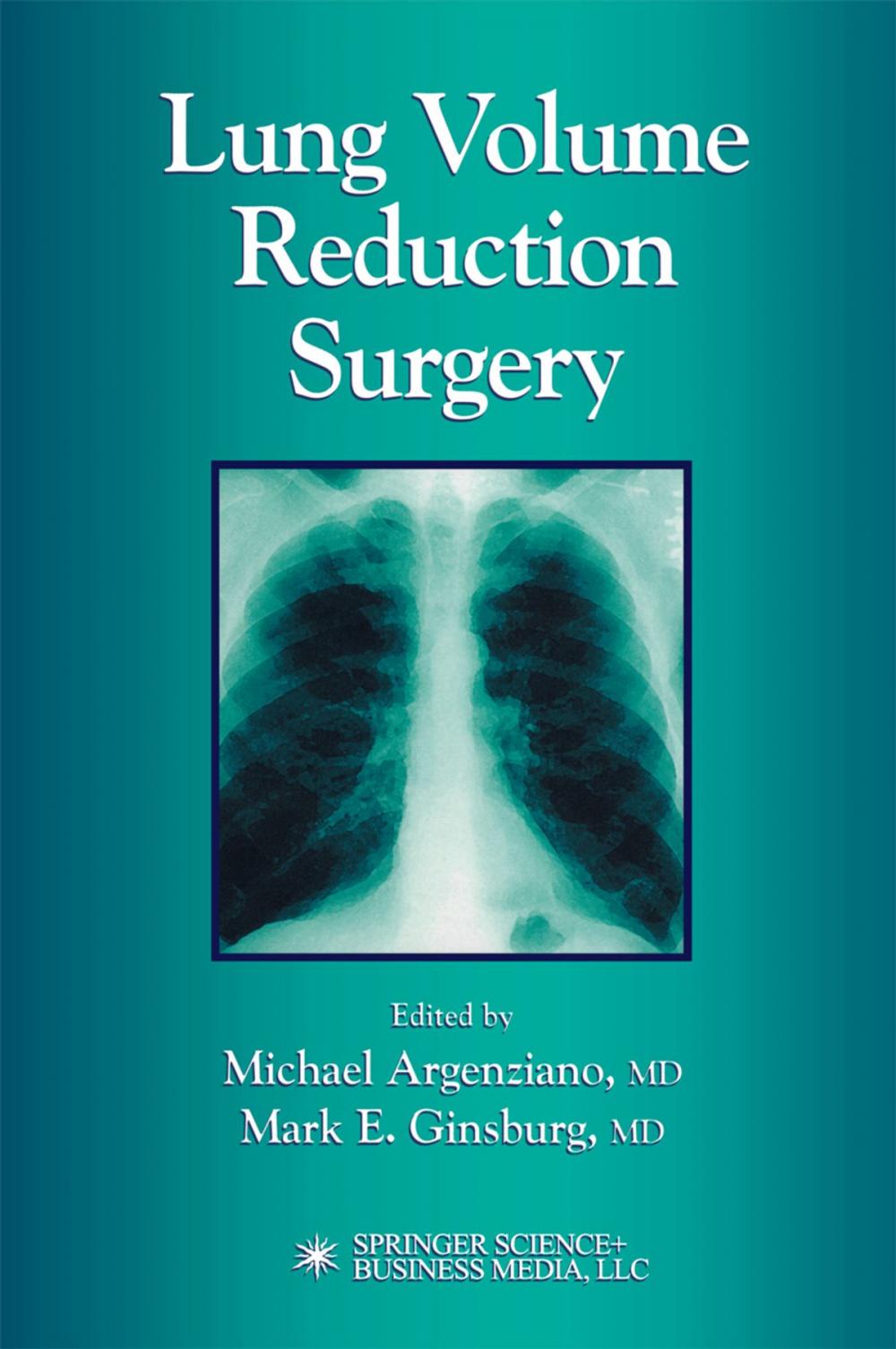 Big bigCover of Lung Volume Reduction Surgery