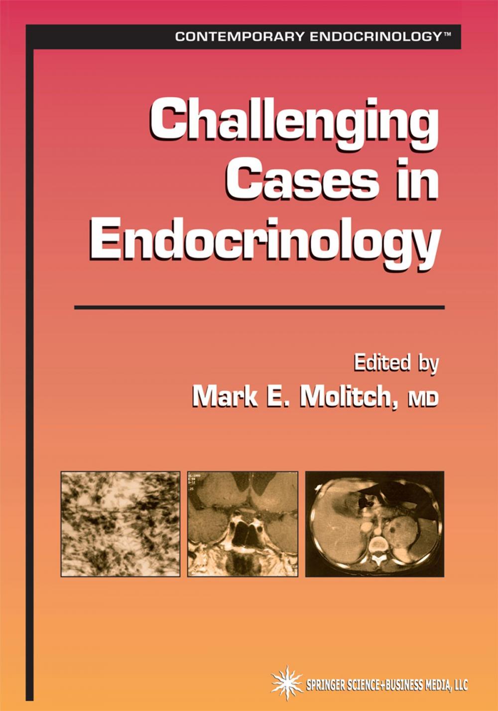 Big bigCover of Challenging Cases in Endocrinology