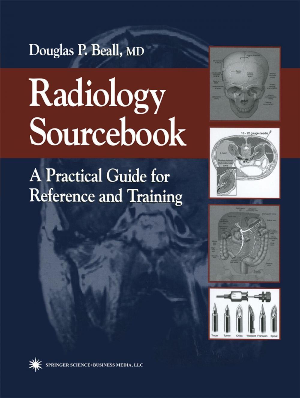 Big bigCover of Radiology Sourcebook