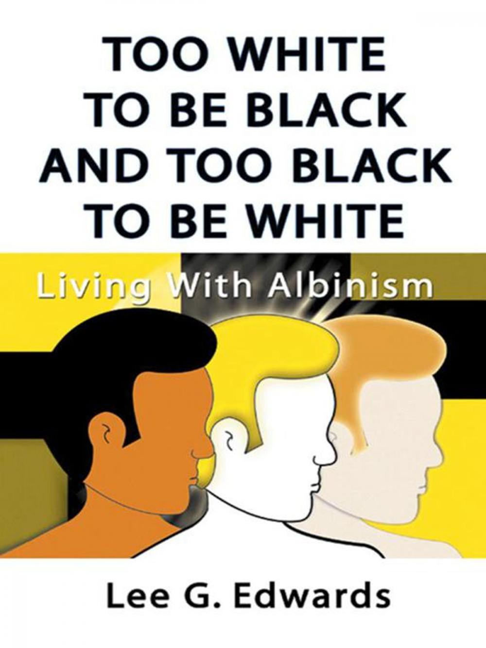 Big bigCover of Too White to Be Black and Too Black to Be White: Living with Albinism