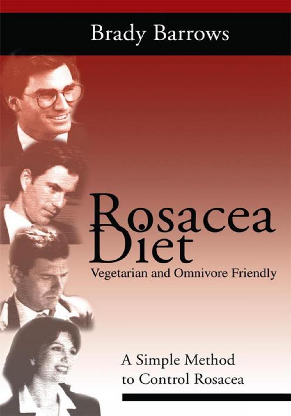 Big bigCover of Rosacea Diet