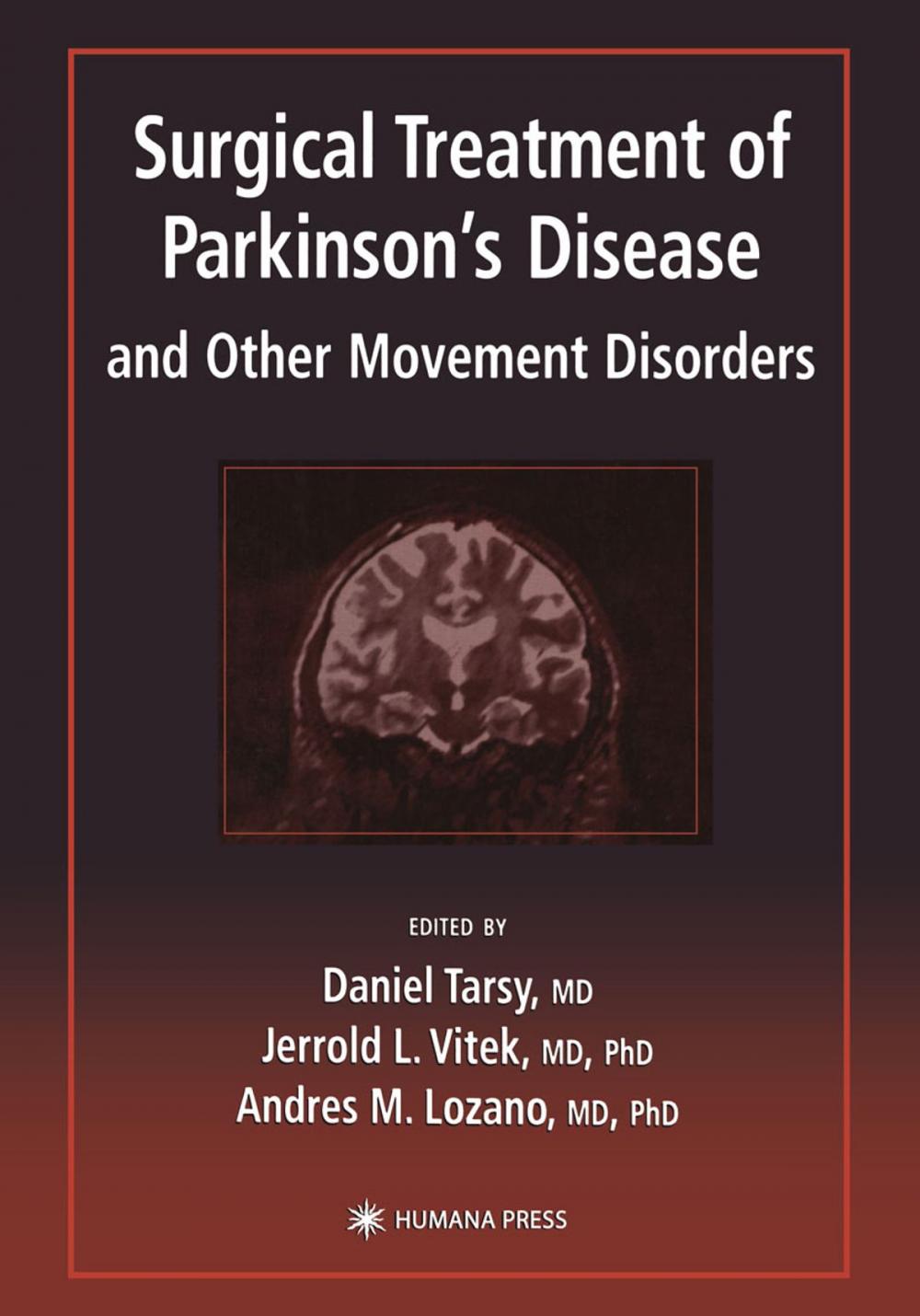 Big bigCover of Surgical Treatment of Parkinson’s Disease and Other Movement Disorders