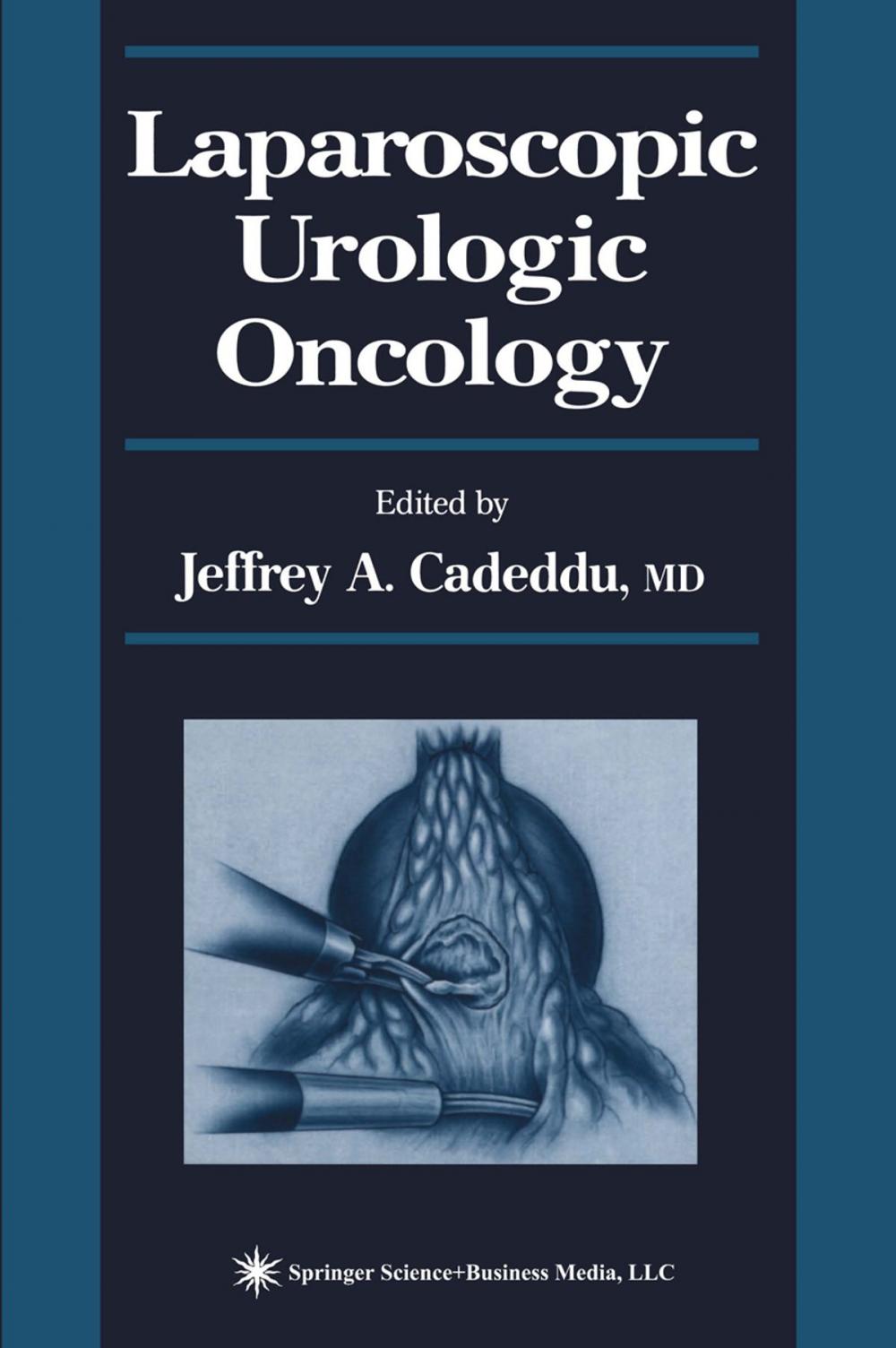 Big bigCover of Laparoscopic Urologic Oncology