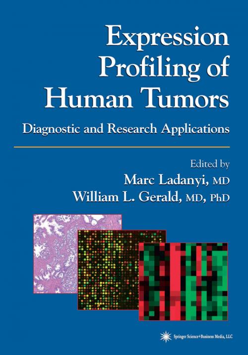 Cover of the book Expression Profiling of Human Tumors by , Humana Press