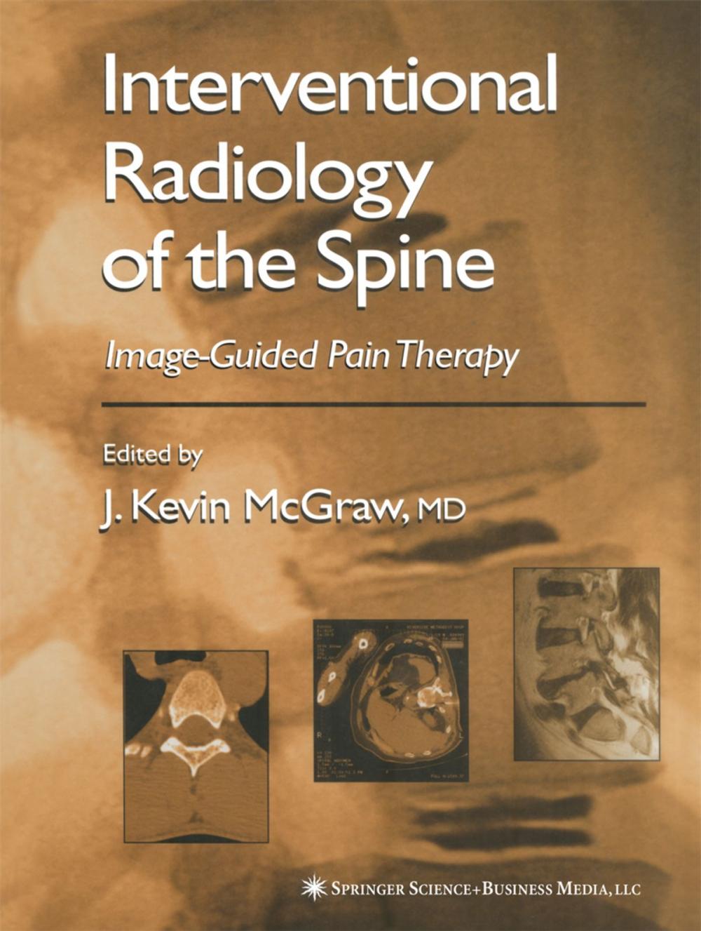 Big bigCover of Interventional Radiology of the Spine