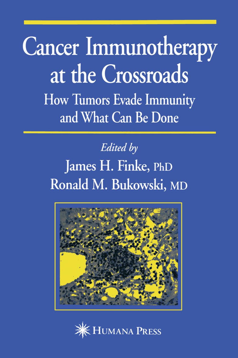 Big bigCover of Cancer Immunotherapy at the Crossroads