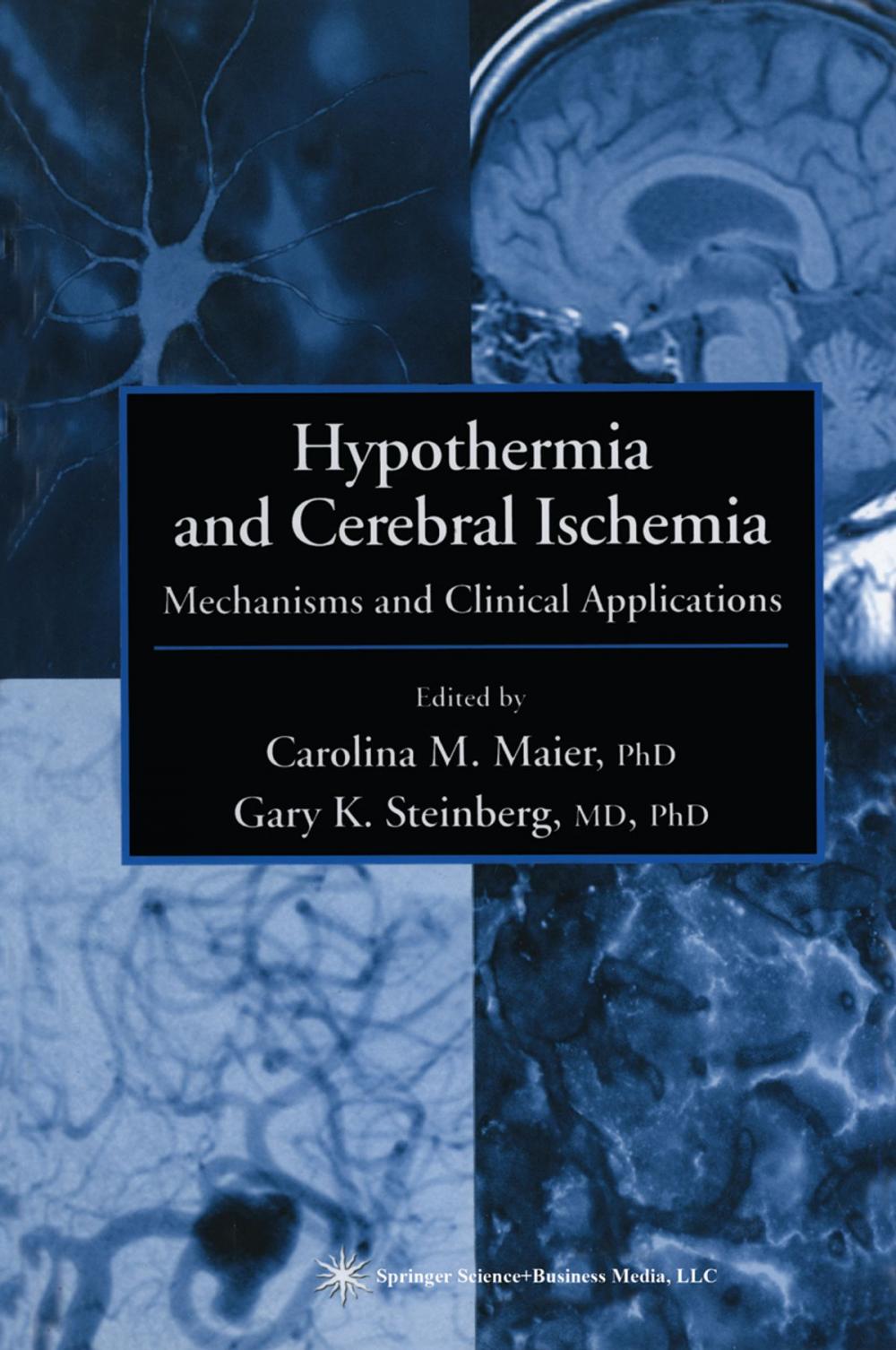 Big bigCover of Hypothermia and Cerebral Ischemia