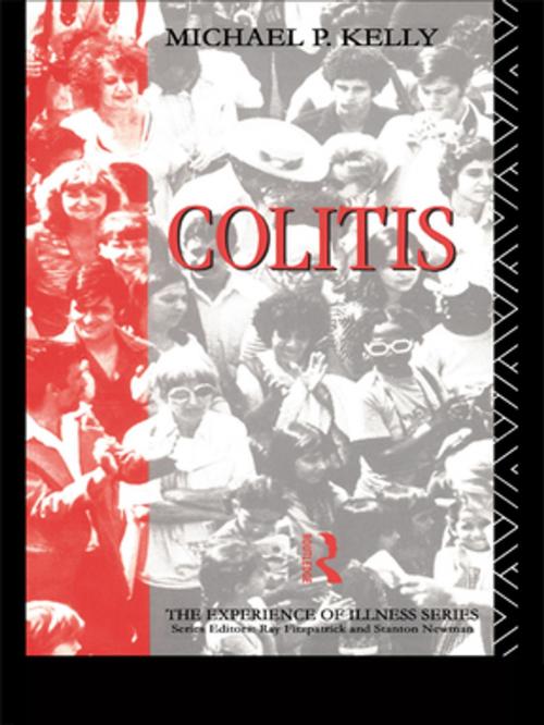 Cover of the book Colitis by Michael P. Kelly, Taylor and Francis