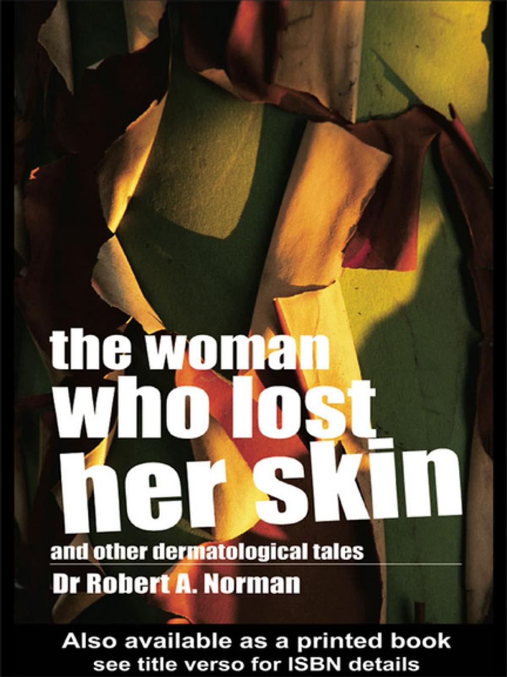 Big bigCover of The Woman Who Lost Her Skin