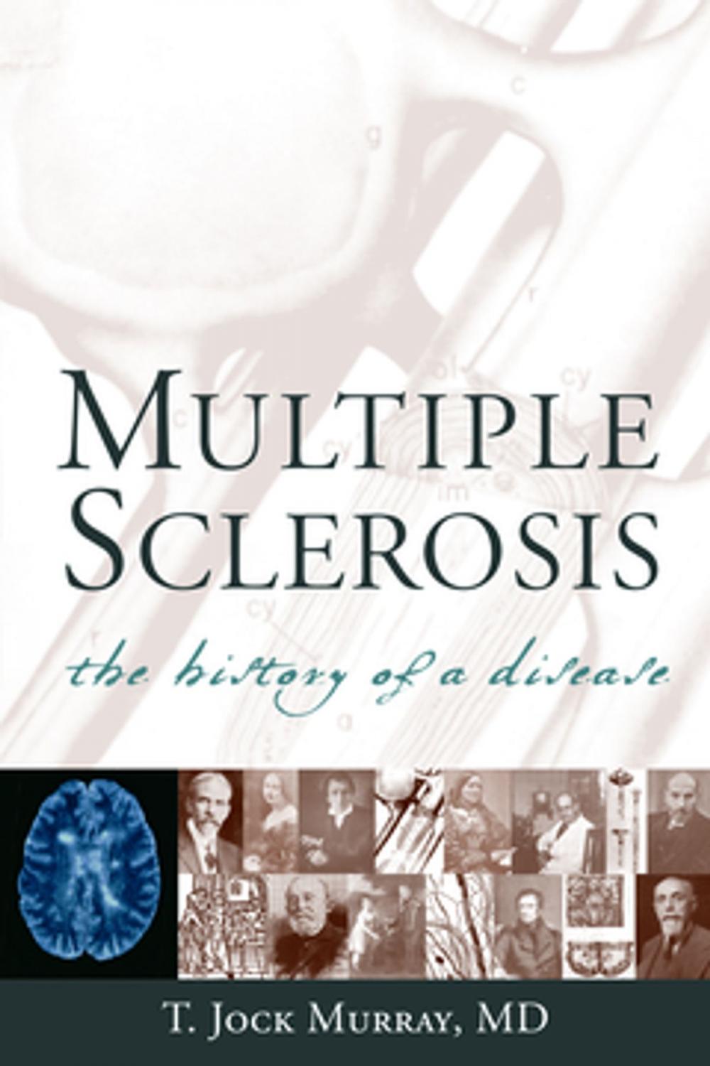 Big bigCover of Multiple Sclerosis