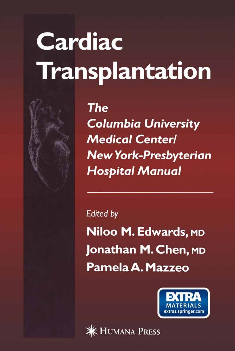 Big bigCover of Cardiac Transplantation