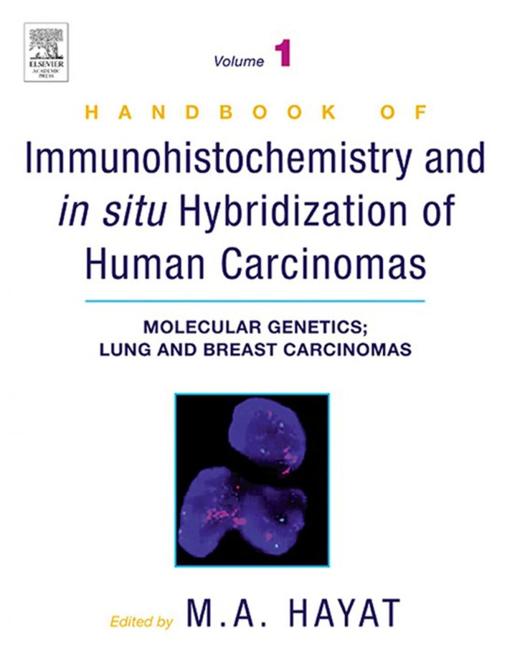 Big bigCover of Handbook of Immunohistochemistry and in Situ Hybridization of Human Carcinomas