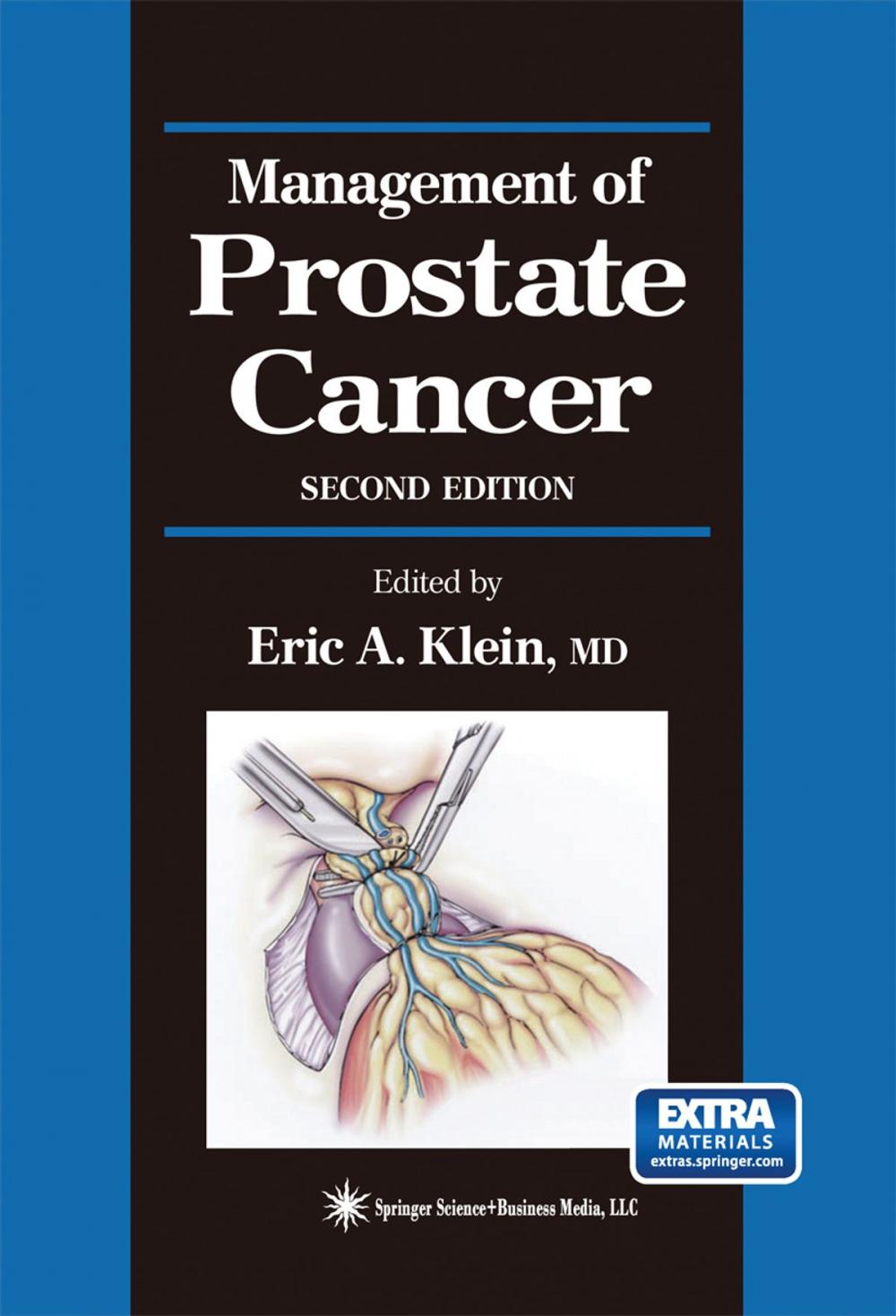 Big bigCover of Management of Prostate Cancer