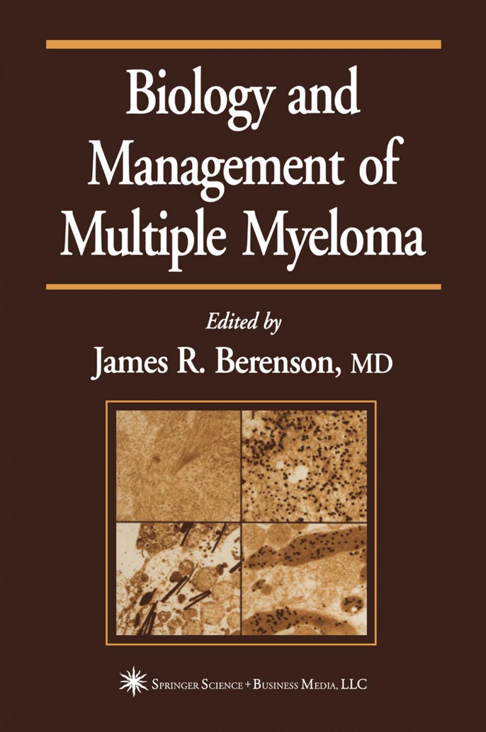 Big bigCover of Biology and Management of Multiple Myeloma