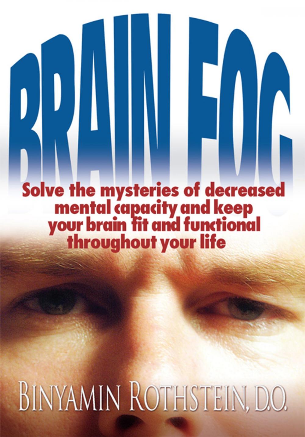 Big bigCover of Brain Fog