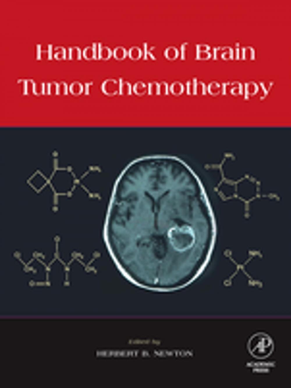 Big bigCover of Handbook of Brain Tumor Chemotherapy