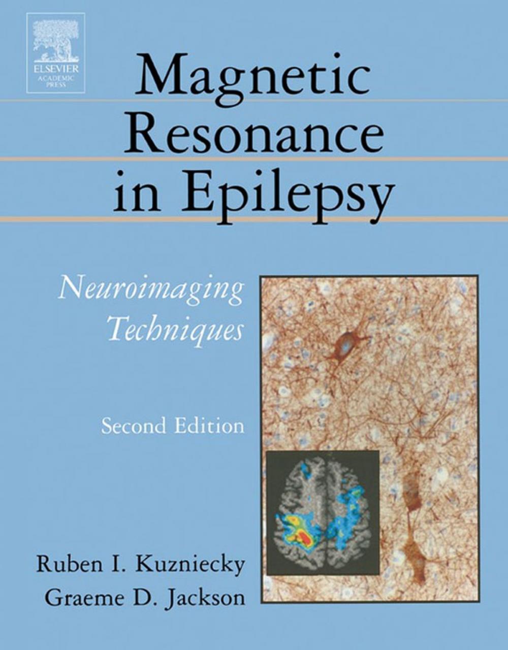 Big bigCover of Magnetic Resonance in Epilepsy