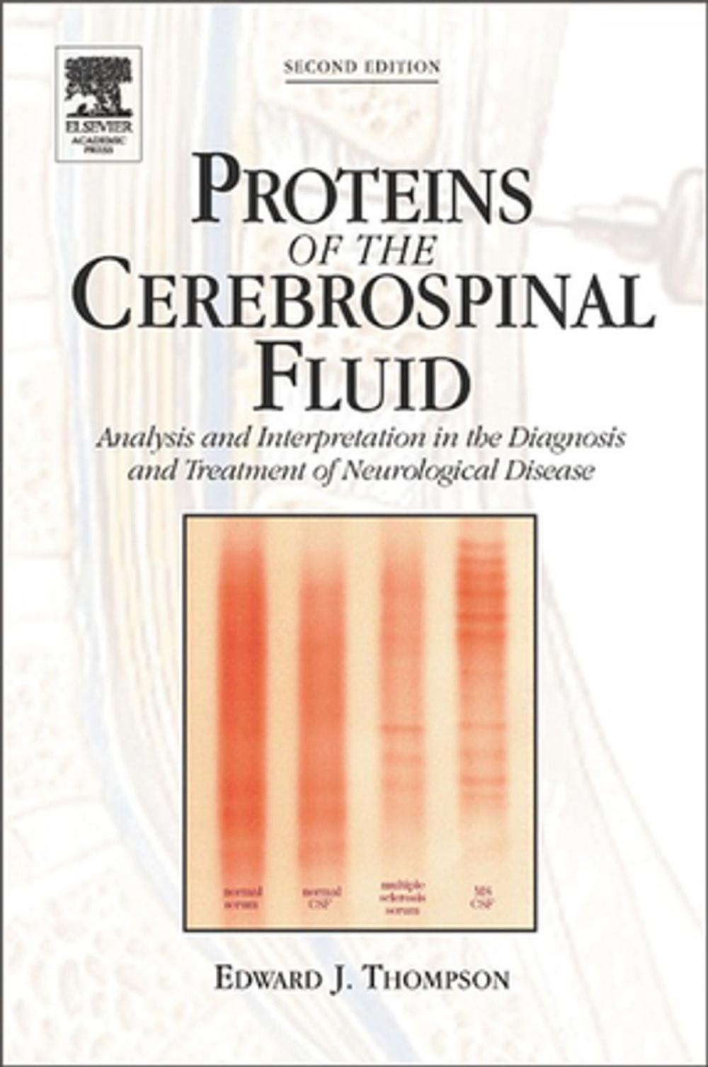 Big bigCover of Proteins of the Cerebrospinal Fluid