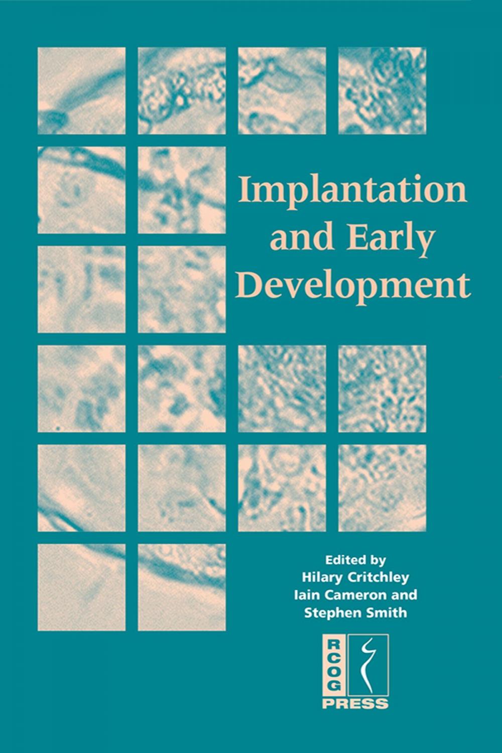 Big bigCover of Implantation and Early Development