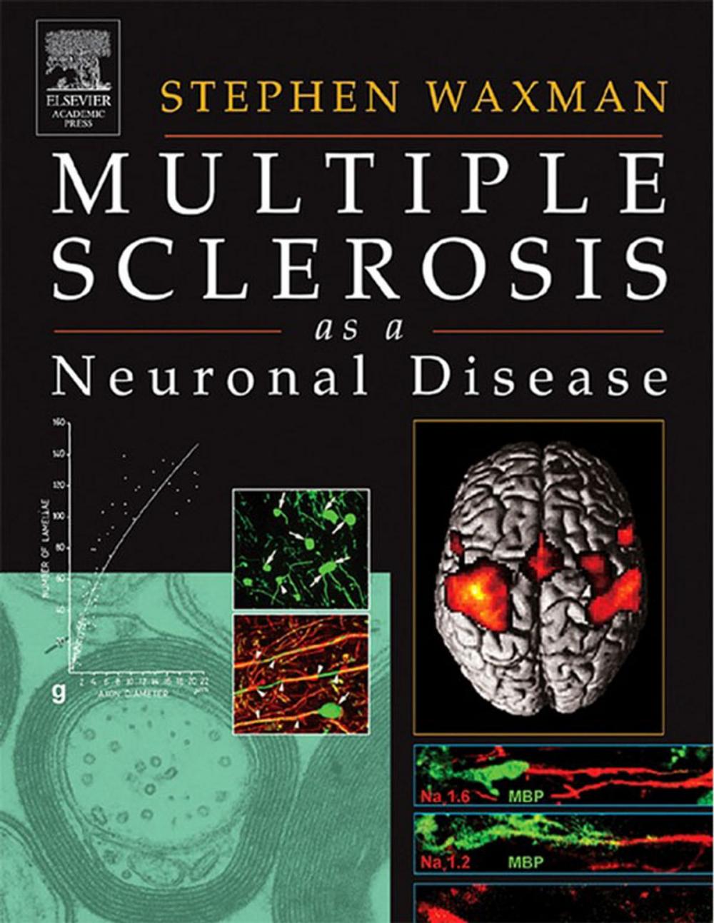 Big bigCover of Multiple Sclerosis As A Neuronal Disease