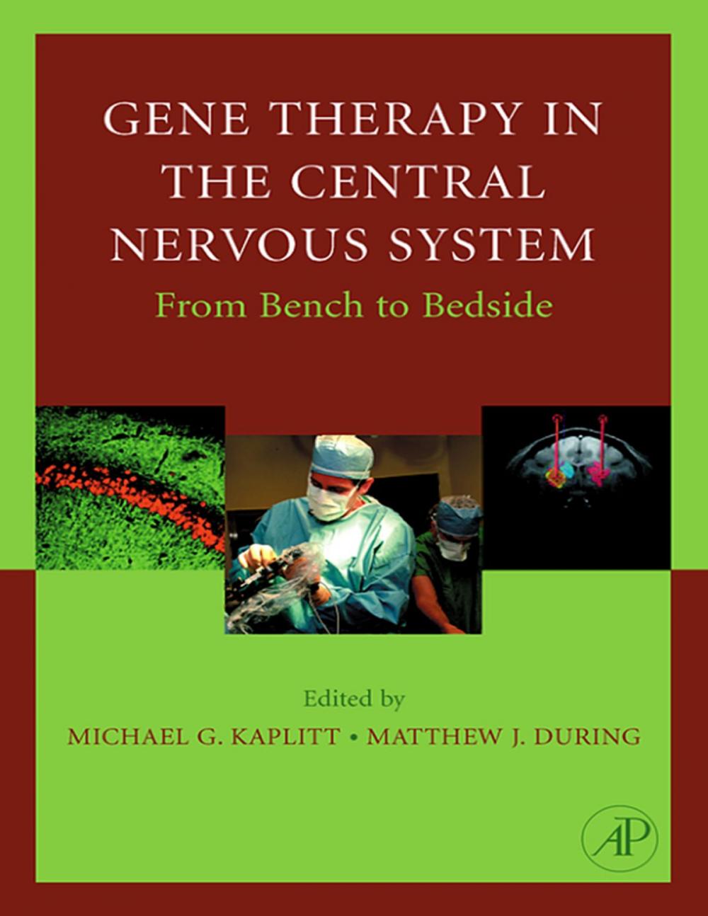 Big bigCover of Gene Therapy of the Central Nervous System: From Bench to Bedside