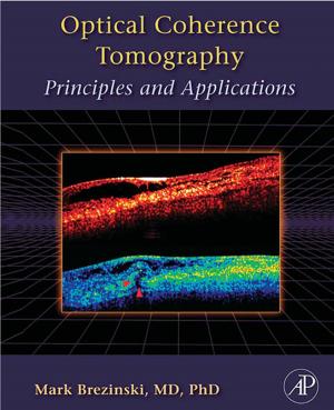 Cover of the book Optical Coherence Tomography by Christopher Barth
