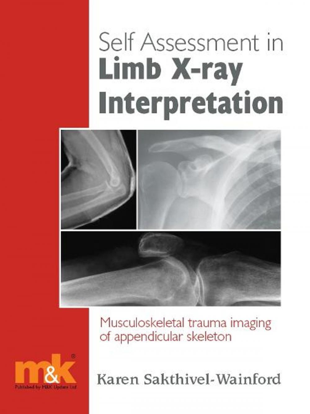 Big bigCover of Self-assessment in Limb X-ray Interpretation