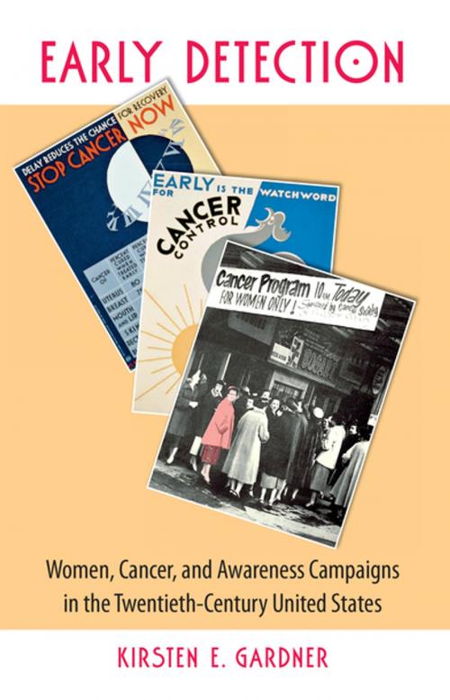 Cover of the book Early Detection by Kirsten E. Gardner, The University of North Carolina Press