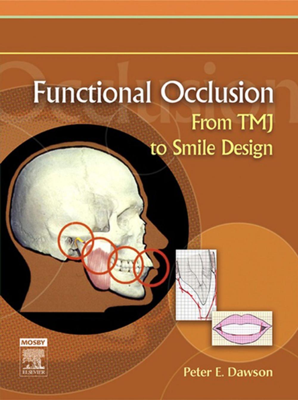 Big bigCover of Functional Occlusion - E-Book