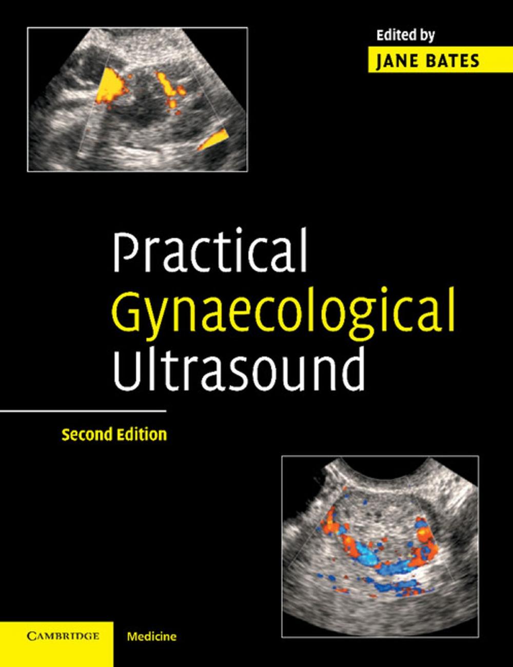 Big bigCover of Practical Gynaecological Ultrasound