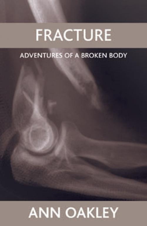 Cover of the book Fracture by Oakley, Ann, Policy Press