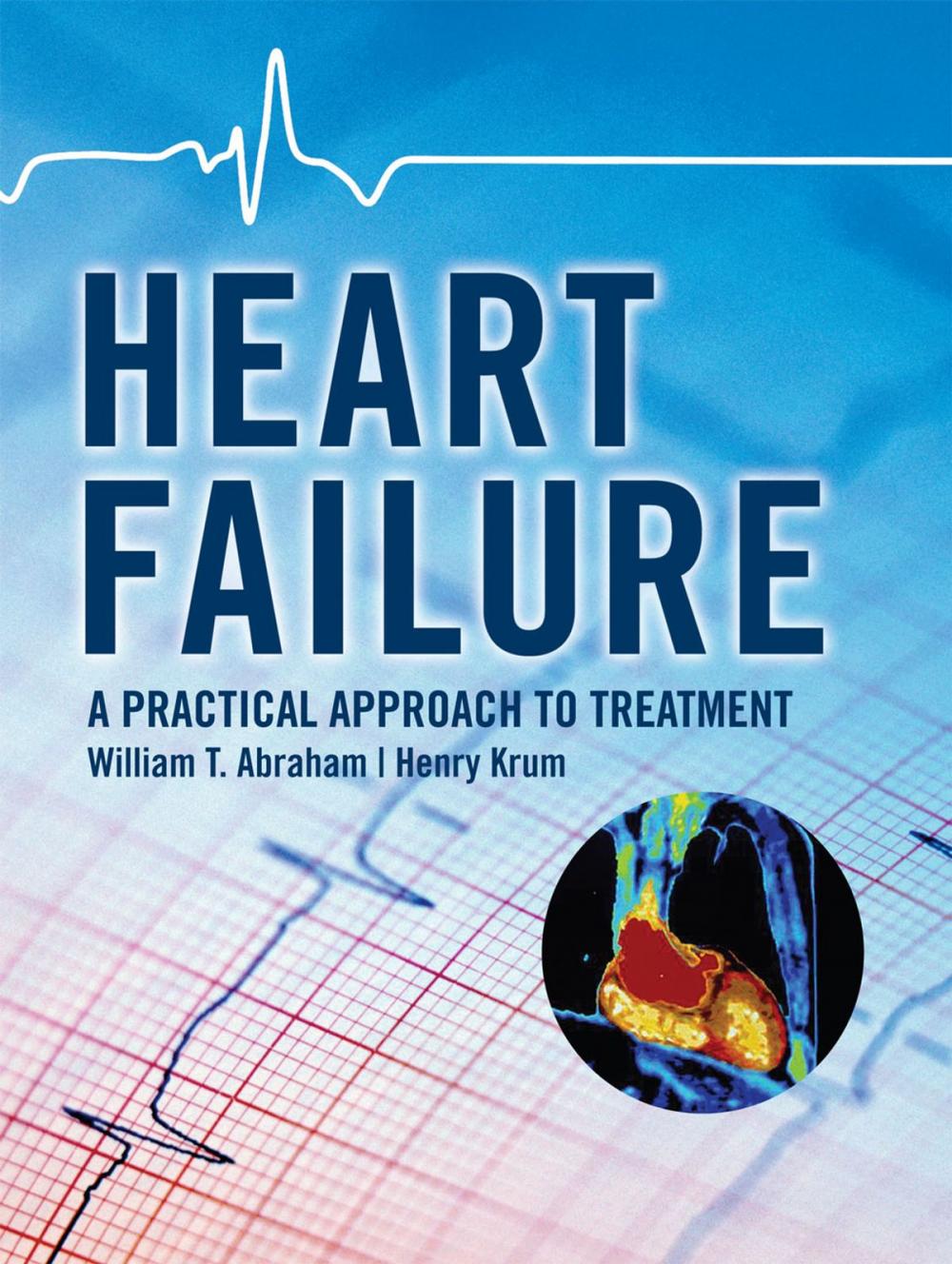 Big bigCover of Heart Failure: A Practical Approach to Treatment