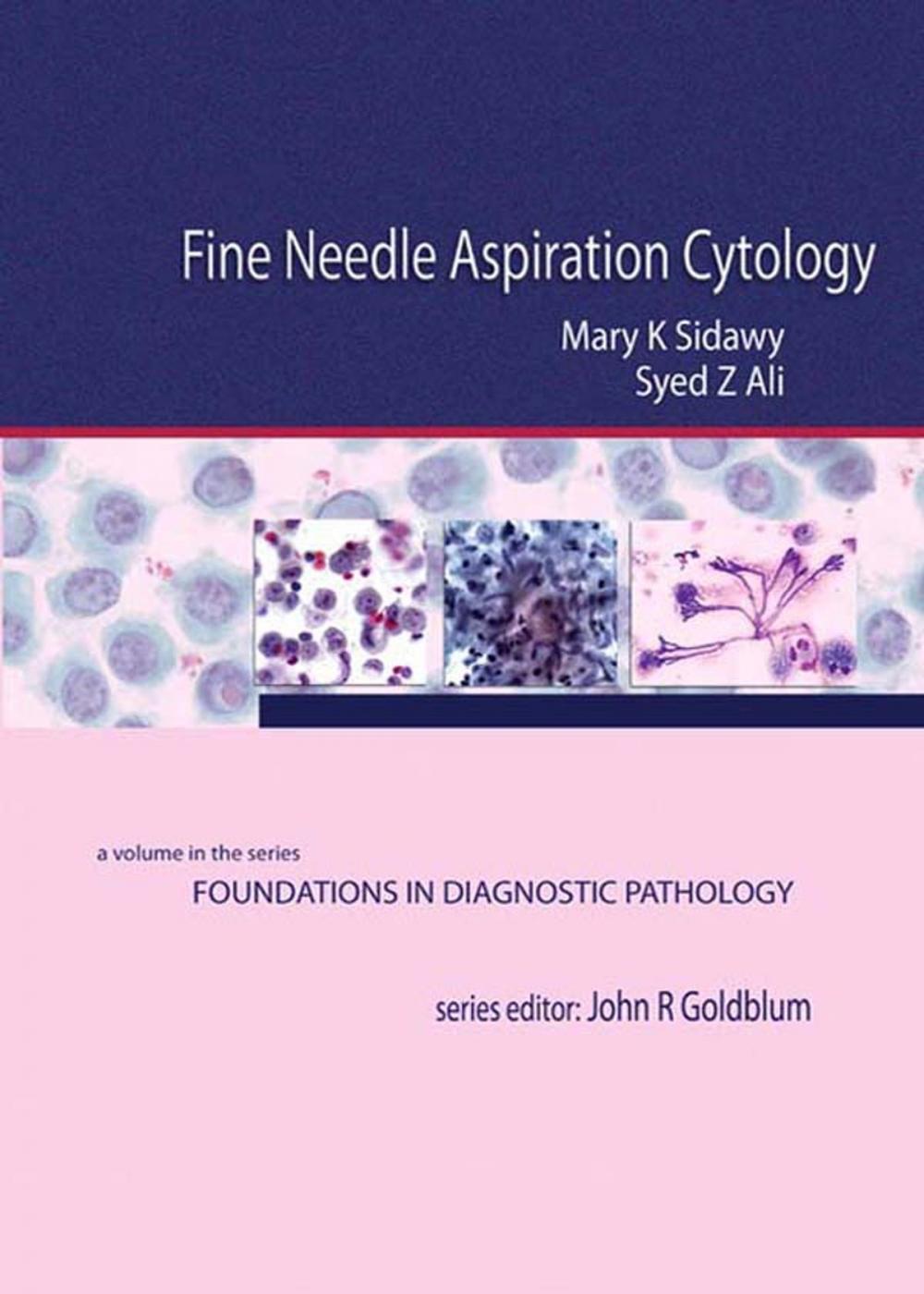 Big bigCover of Fine Needle Aspiration Cytology E-Book