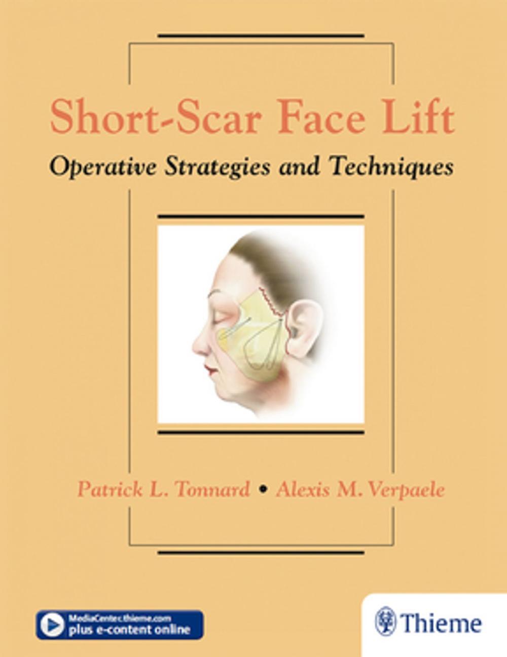 Big bigCover of Short-Scar Face Lift