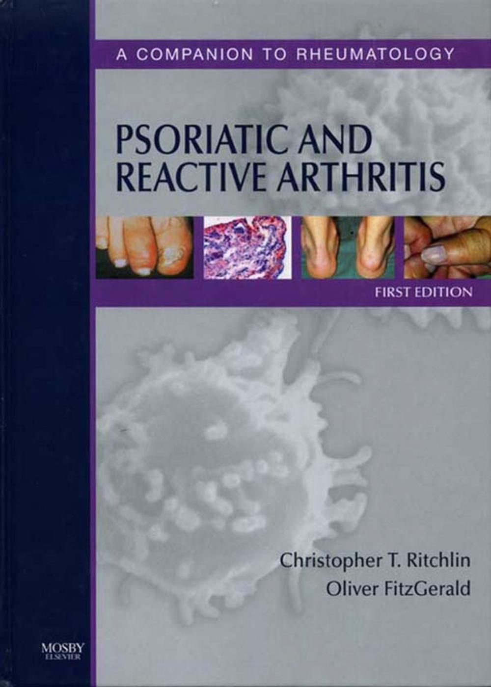 Big bigCover of Psoriatic and Reactive Arthritis E-Book