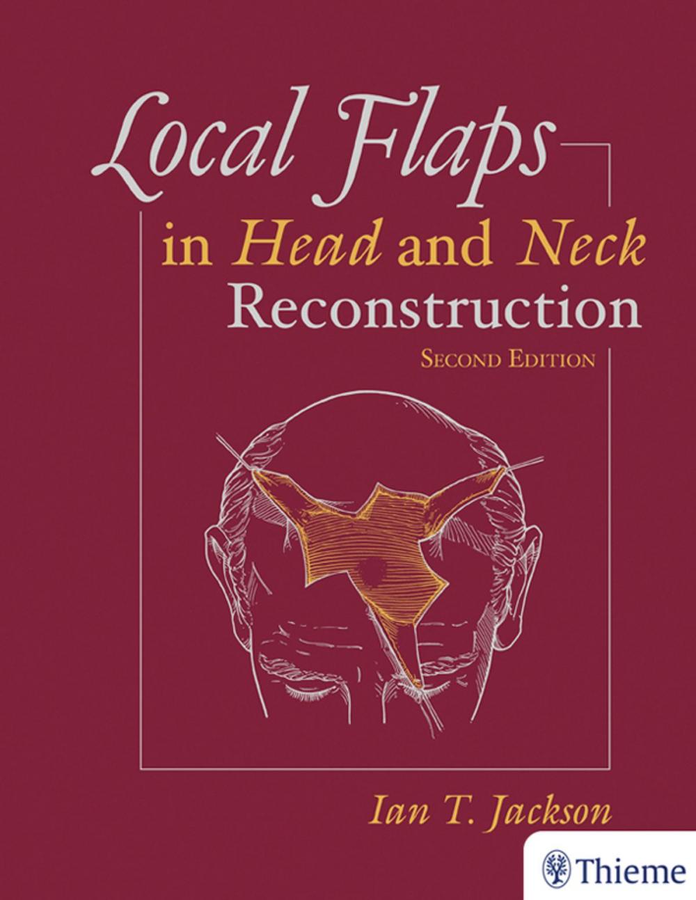 Big bigCover of Local Flaps in Head and Neck Reconstruction