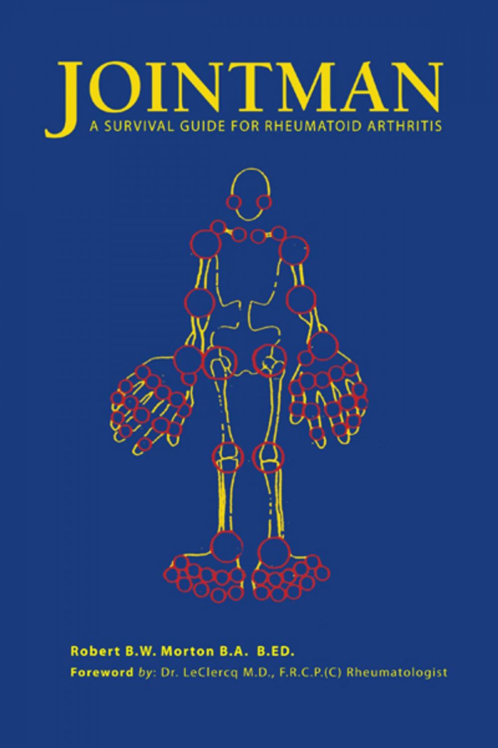 Big bigCover of Jointman, a Survival Guide for Rheumatoid Arthritis