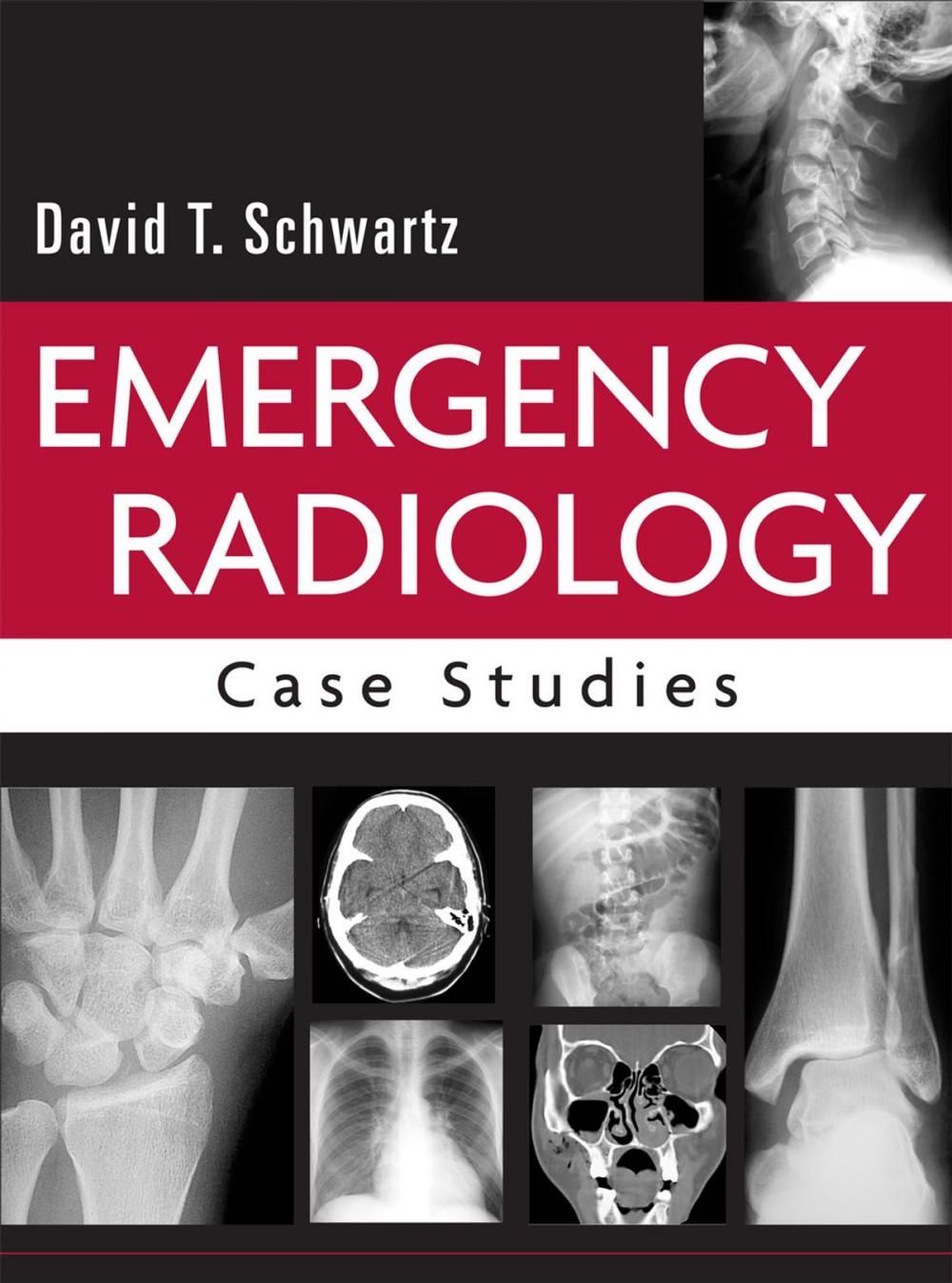 Big bigCover of Emergency Radiology: Case Studies