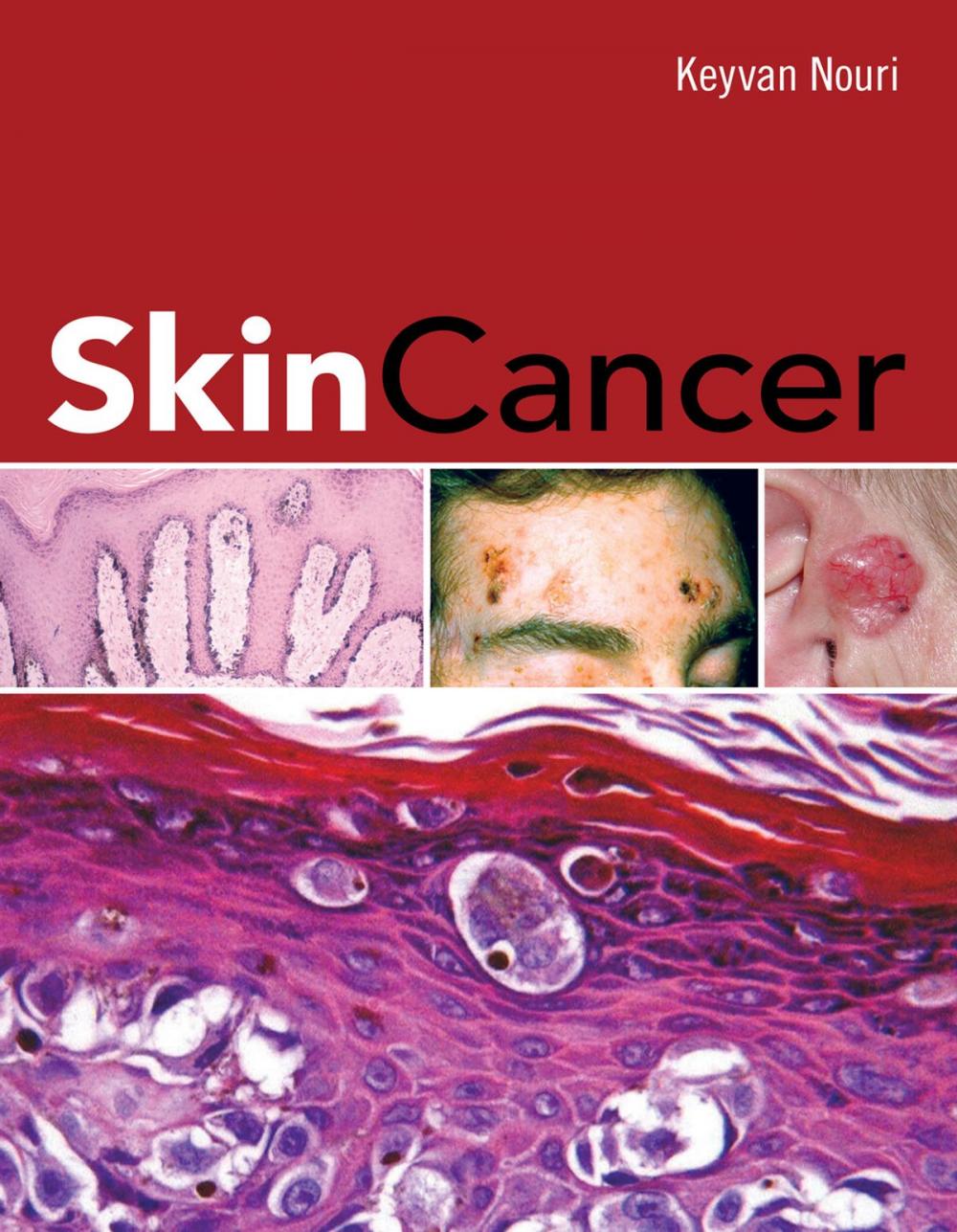 Big bigCover of Skin Cancer