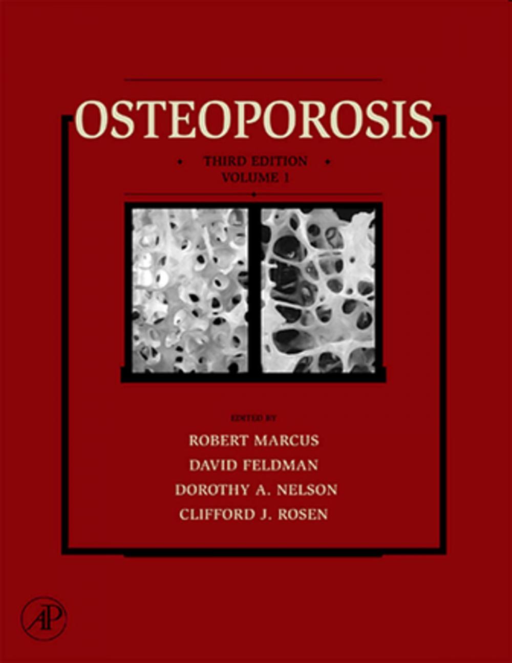 Big bigCover of Osteoporosis