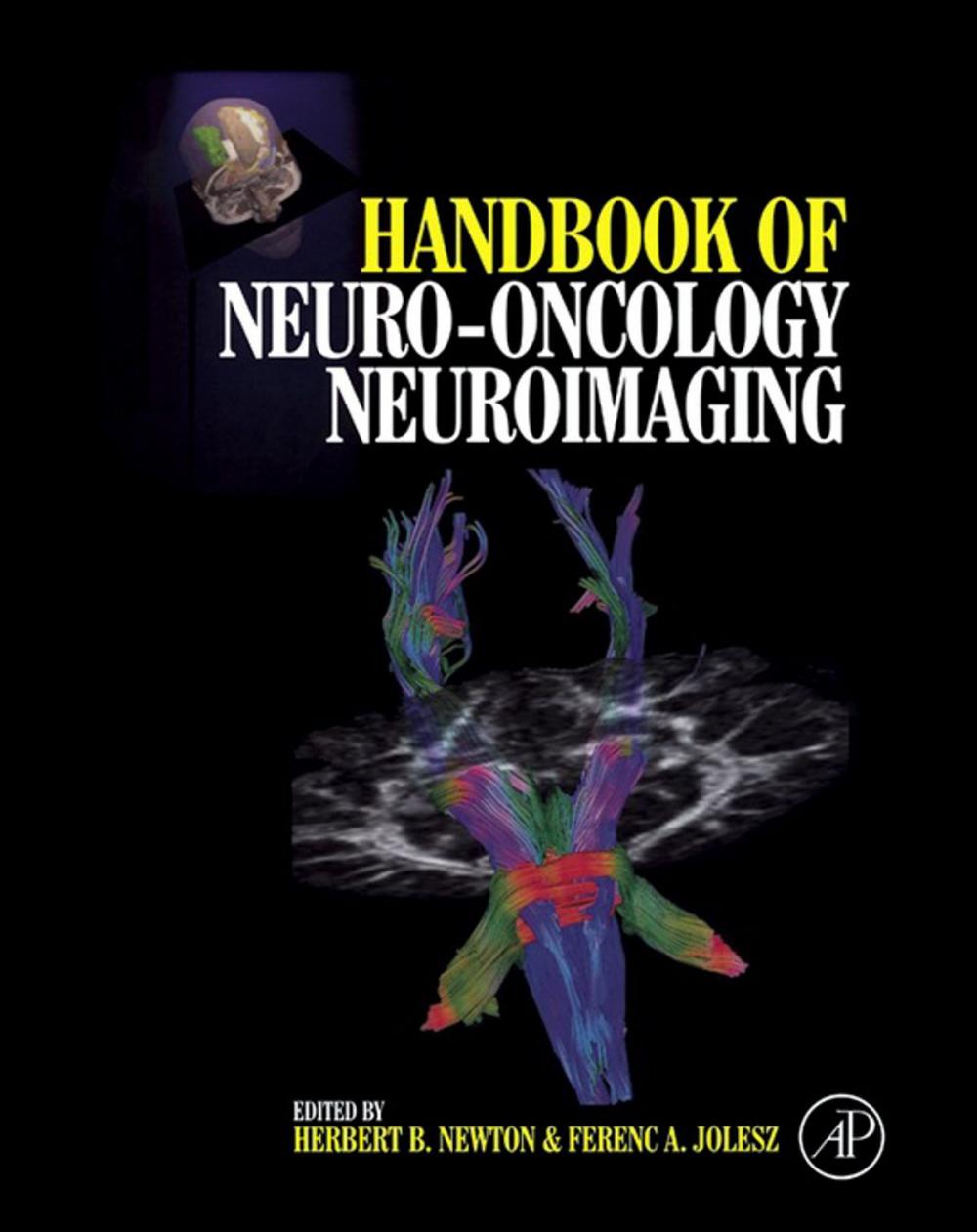 Big bigCover of Handbook of Neuro-Oncology Neuroimaging