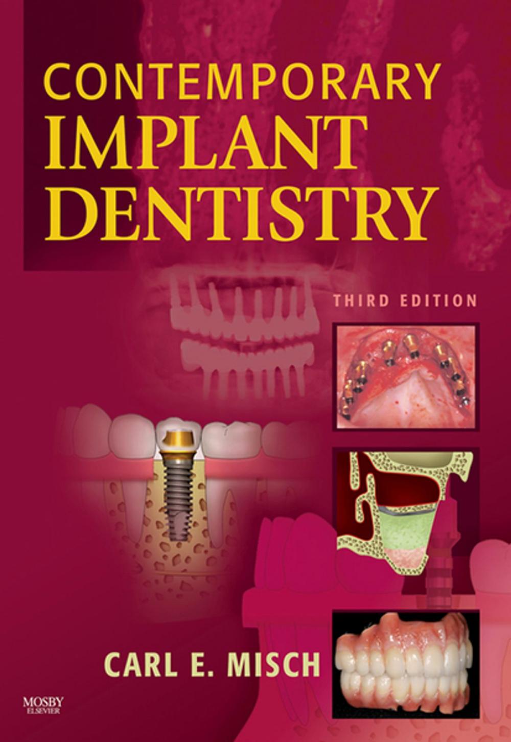 Big bigCover of Contemporary Implant Dentistry