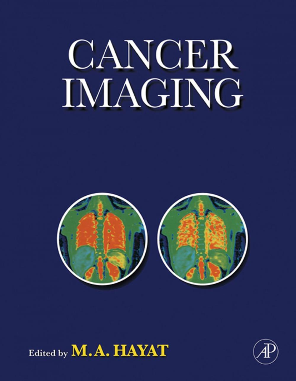 Big bigCover of Cancer Imaging