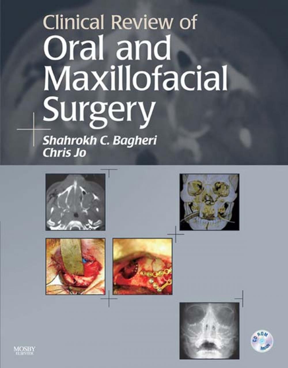 Big bigCover of Clinical Review of Oral and Maxillofacial Surgery - E-Book